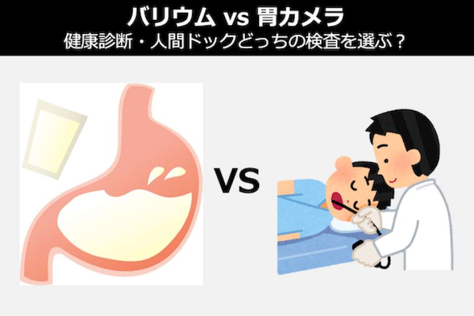 【バリウム vs 胃カメラ】健康診断・人間ドックどっちの検査を選ぶ？人気投票！